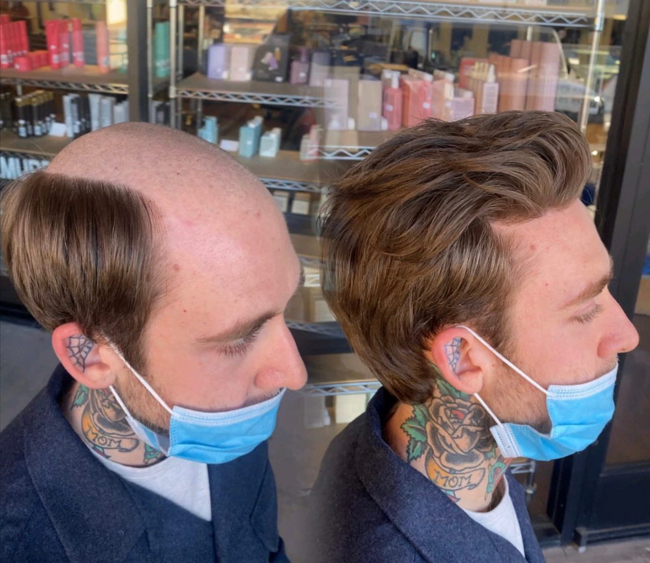 Hair system consultation step in Charlotte, North Carolina