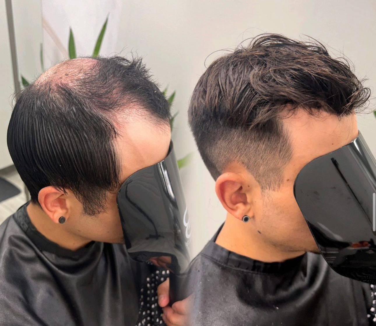 Hair system style example for Charlotte, North Carolina consultation