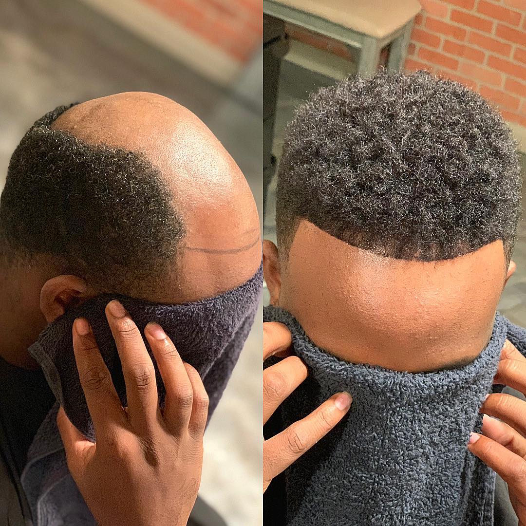 Hair replacement style inspiration for Charlotte, North Carolina