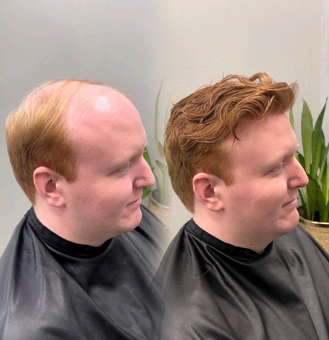 Non-surgical hair system inspiration for Charlotte, North Carolina